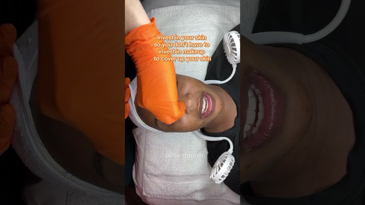 The Perfect Derma™ Peel benefits ALL skin types + tones!