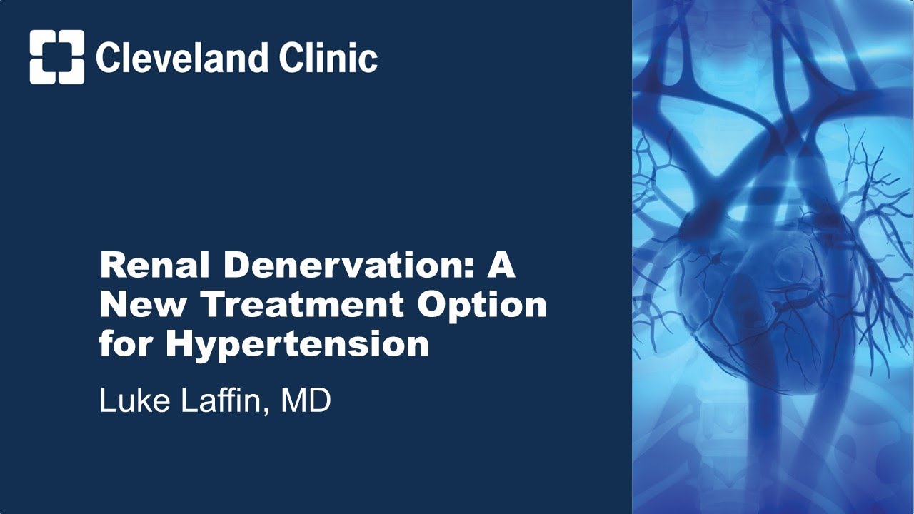 Renal Denervation: A New Treatment Option for Hypertension