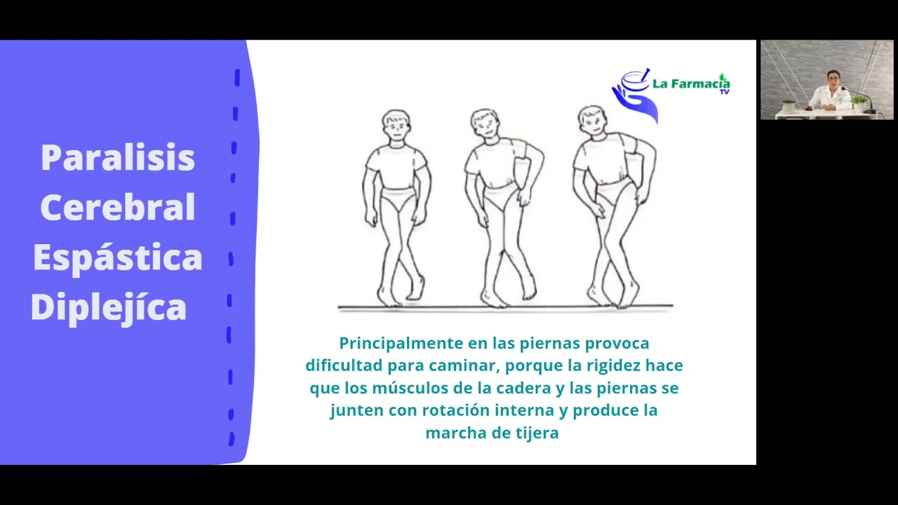 Parálisis Cerebral Infantil