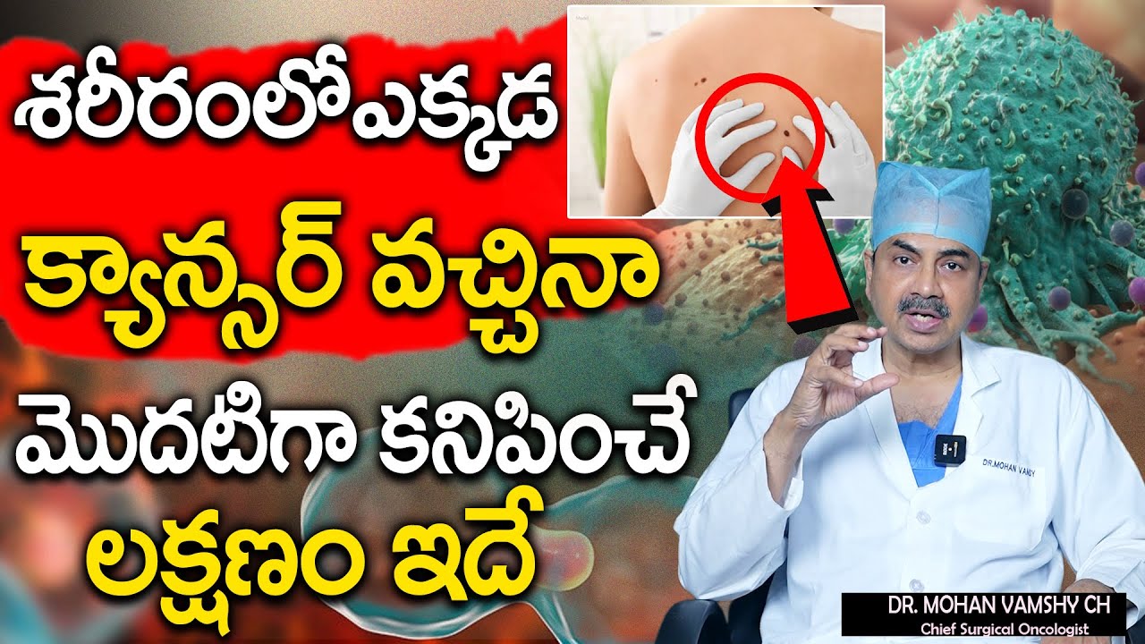 ఒంట్లో కాన్సర్ కణాలు ఉంటె కనిపించే సూచనలు || Dr.Mohan Vamsi About Cancer || Sumantv health Care