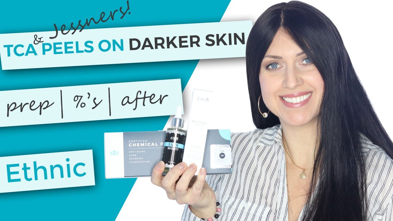 TCA & Jessner Peels on Ethnic | Olive | Darker Skin | Preparation | Percentages | After Care | Body