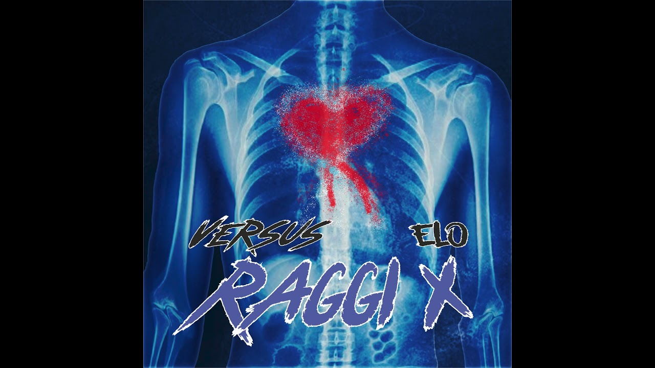 Versus x Elo - Raggi X (VISUAL)