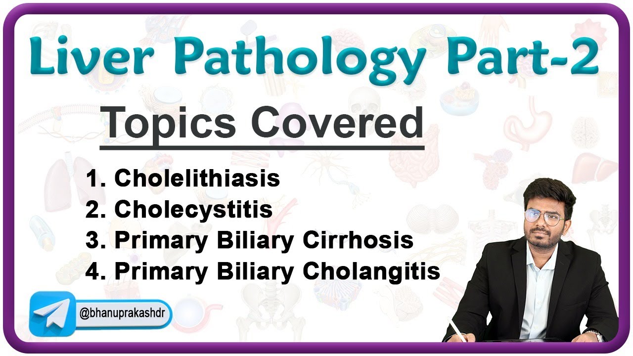 Liver Pathology : Cholelithiasis, Cholecystitis, Primaribiliary Cirrohosis and Cholangitis