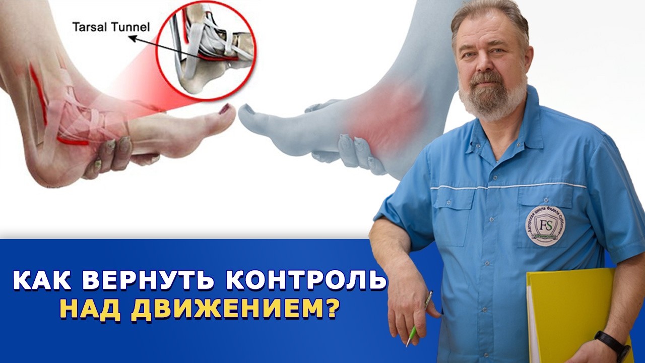 Онемение ушло, а проблемы остались? Как вернуть нормальное движение!