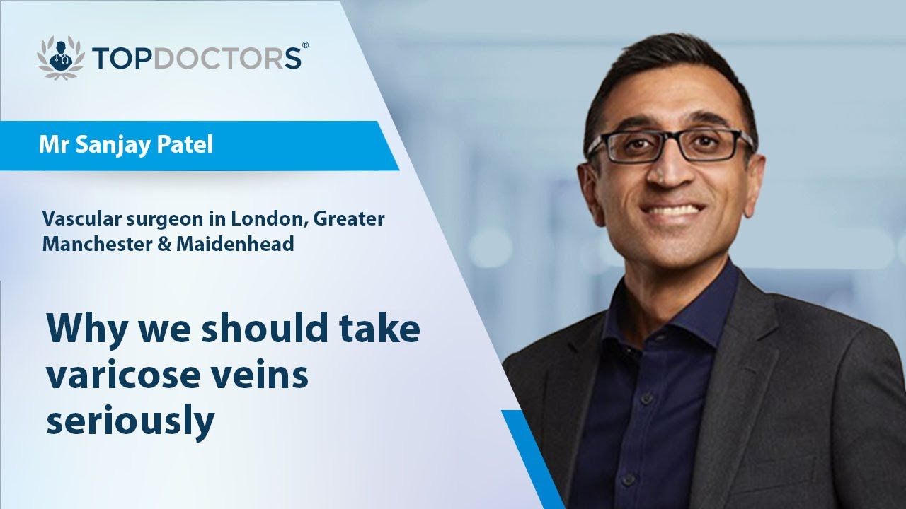 Why we should take varicose veins seriously - Online interview