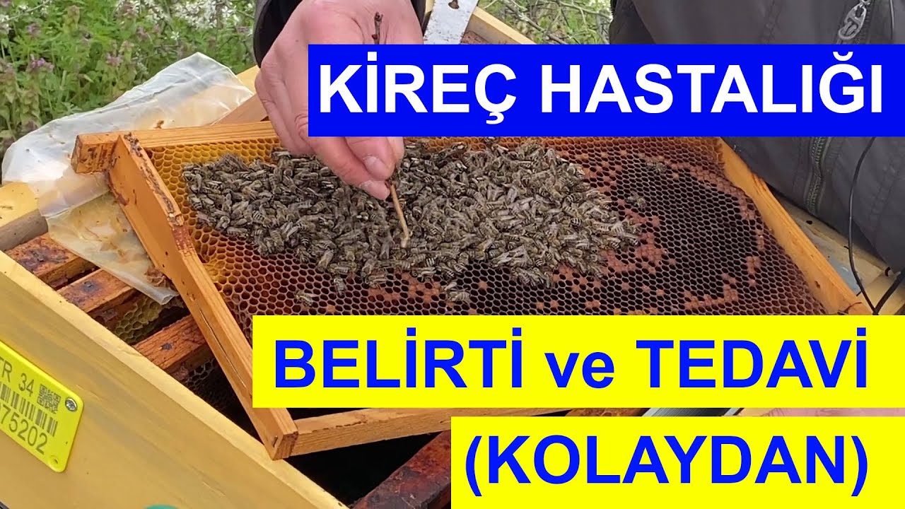 Kireç Hastalığı Belirtileri ve Tedavi (Kolaydan)