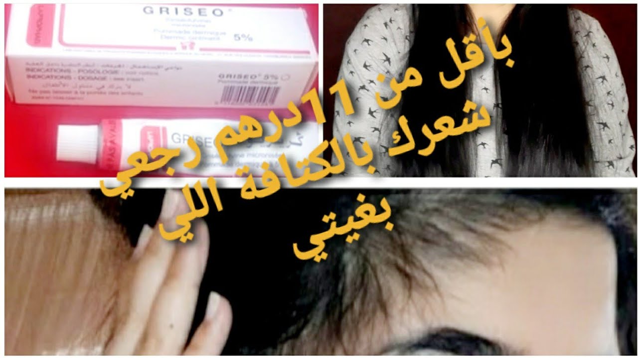 بومادا او مرهم خطيييير في كتافة الشعر و تطويله و يعالج داء التعلبة بسرعة جربتو و صدمني#قنبلة_الموسم#