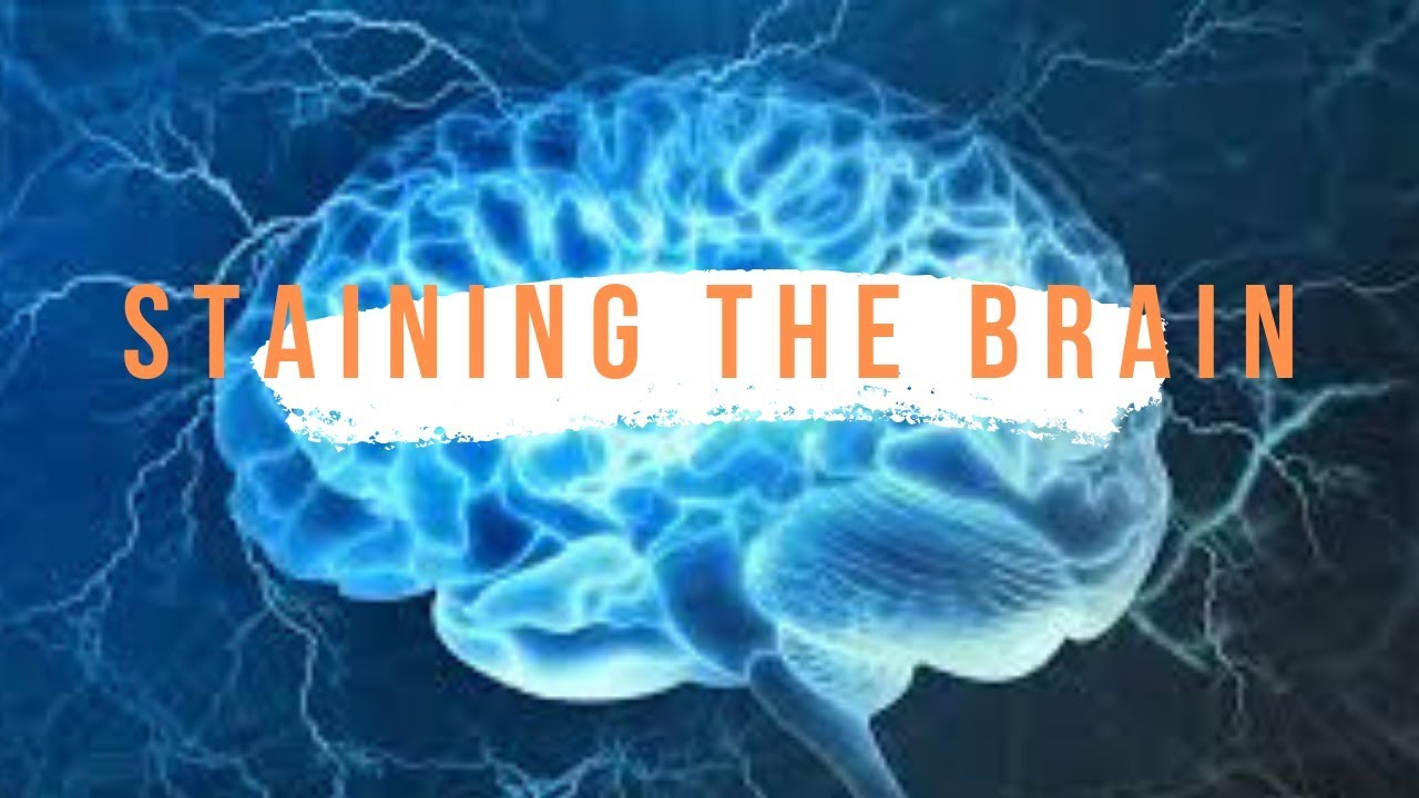 Nobel Prizes Explained: Brain Stain