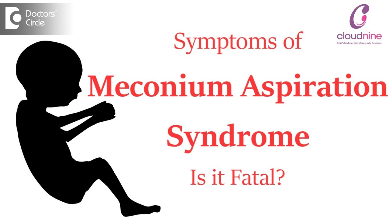 What are the signs & symptoms of Meconium Aspiration Syndrome?Can this be fatal?-DrPiyush Jain of C9
