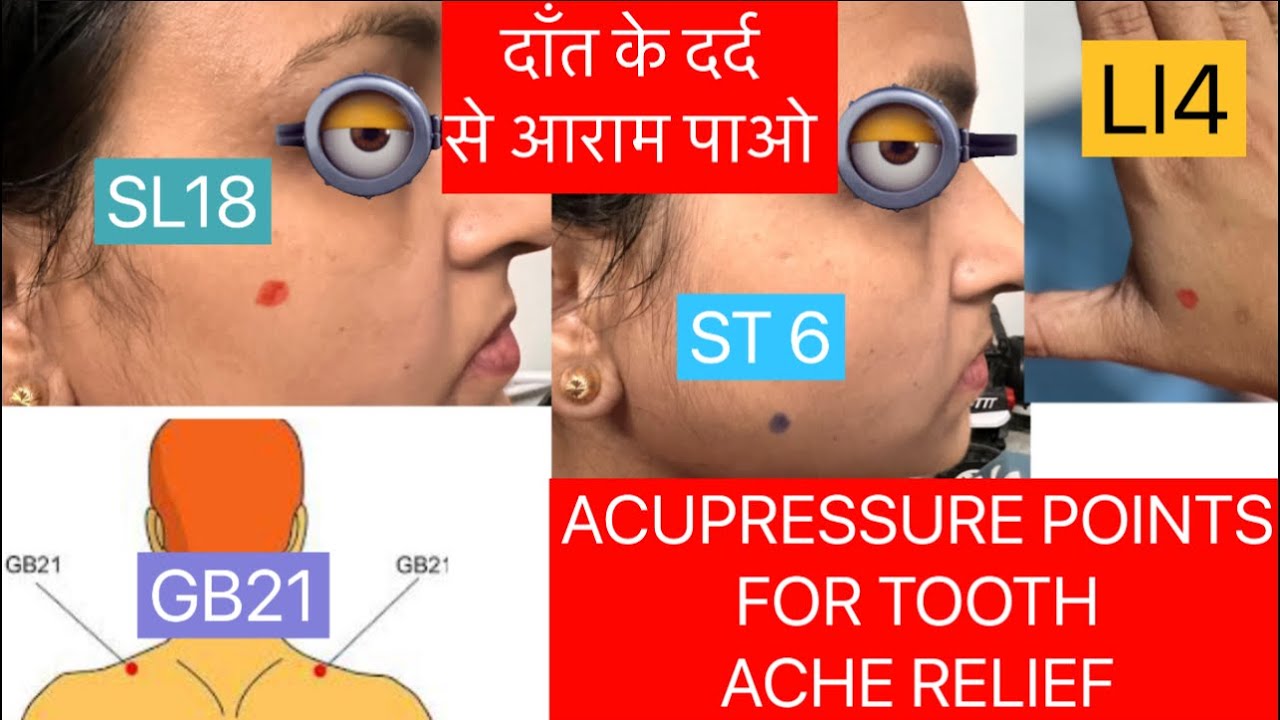 |Acupressure points for toothache relief| #acupressure#toothache#homeremedies#oralhealth#relief