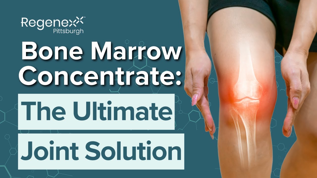 What is Bone Marrow Concentrate? Amazing Facts! | Regenexx Pittsburgh