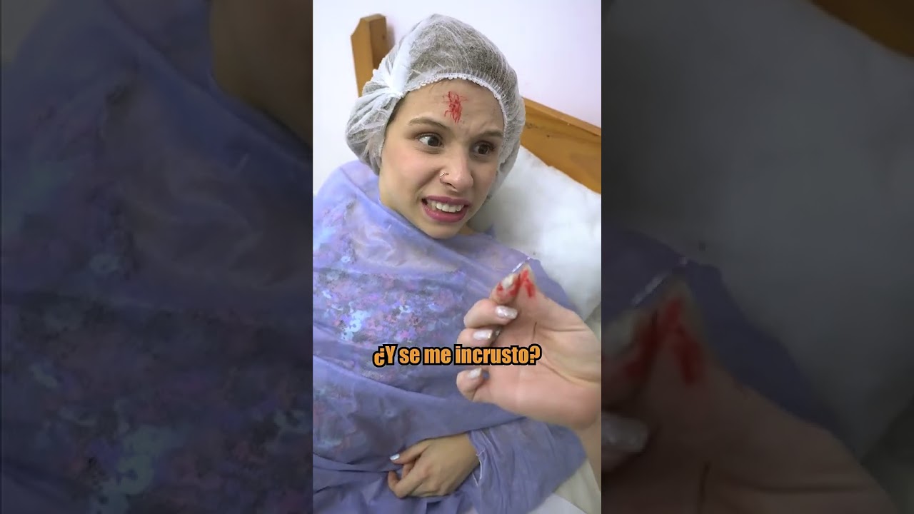 Le queda incrustado en la cabeza el DIU de su madre al momento de su nacimiento #novelas #drmilagro