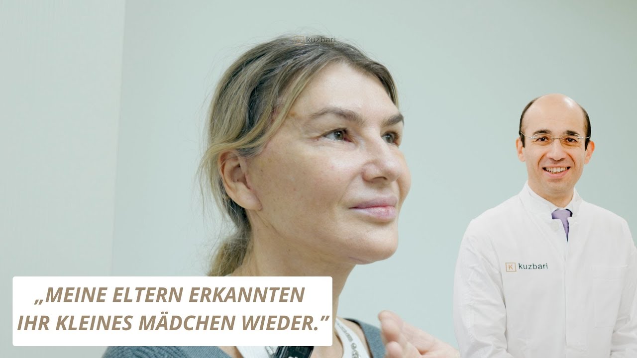 So sieht ein Facelift nach 1 Monat wirklich aus!