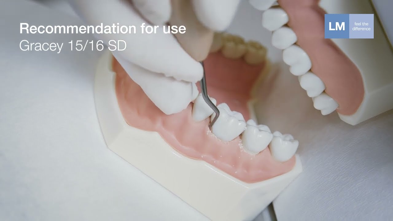 How to use Gracey 15/16 SD LM™ hand instrument