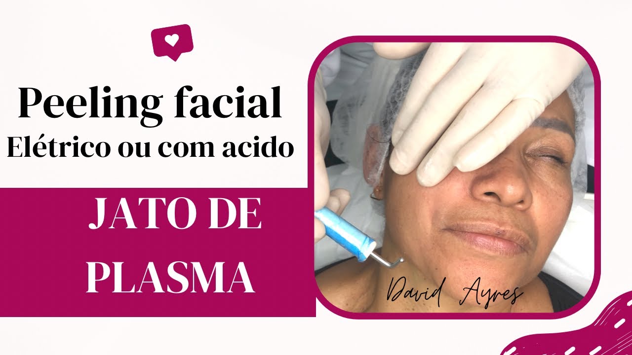 Peeling Facial com Jato de Plasma