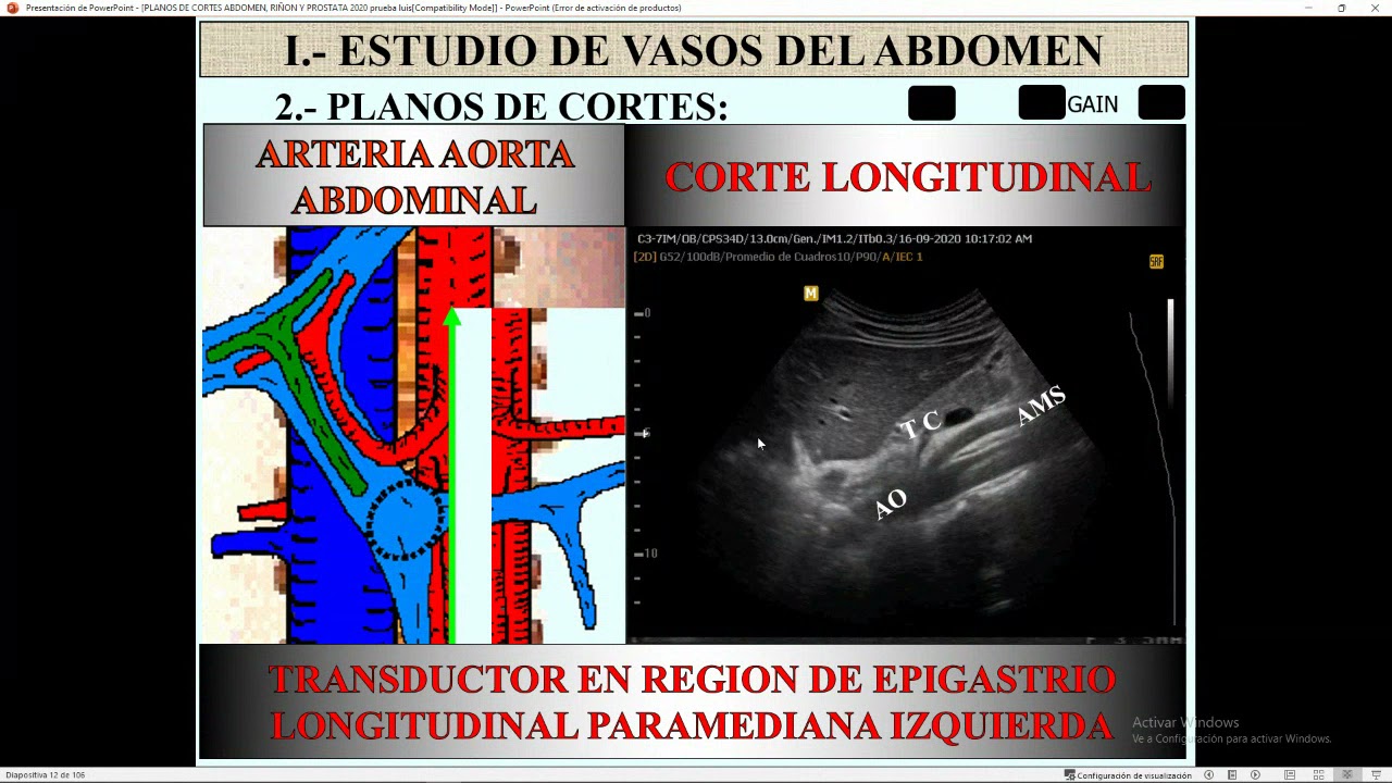 Tema  Cortes Ecograficos   Higado y Pancreas   1pm   5pm   Dr  E  Tamashiro   record