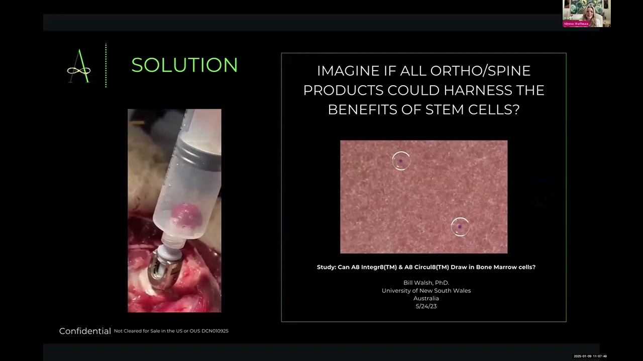 #AlyssaHuffman @ALLUMIN8 on better #pedicle screw system that puts #patients 1st #Pitch3D #demoday