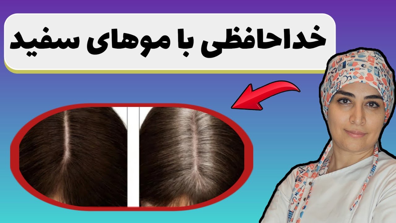 با موهای سفید خداحافظی کنید.با روش های خانگی خیلی راحت موهای سیاه و خوش حالت داشته باش🩷