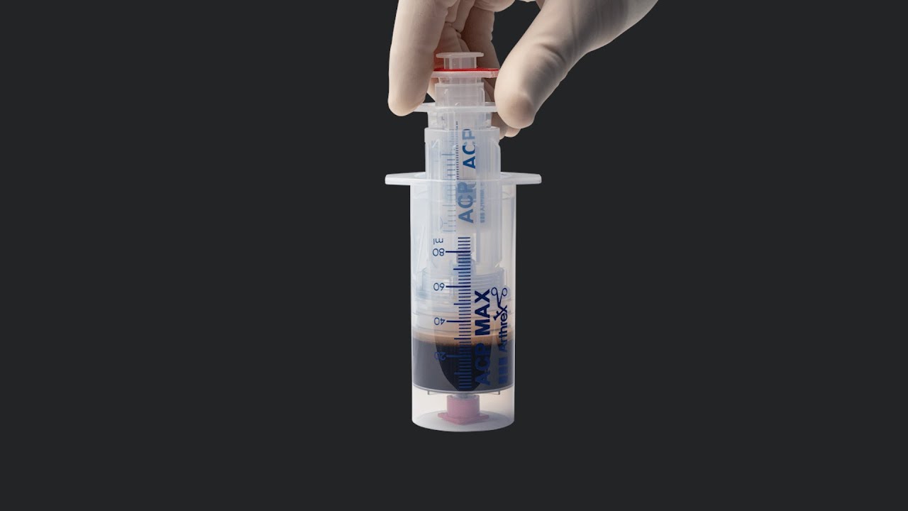 Создание PRP с помощью системы ACP Max™ PRP