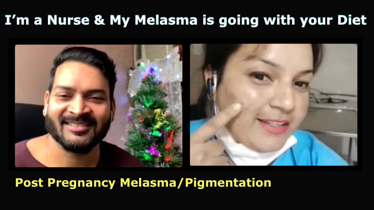 Pigmentation/Melasma Post Pregnancy. 2 महीनों में ही आपकी Diet से मेरी झाइयाँ फूटने लगी।