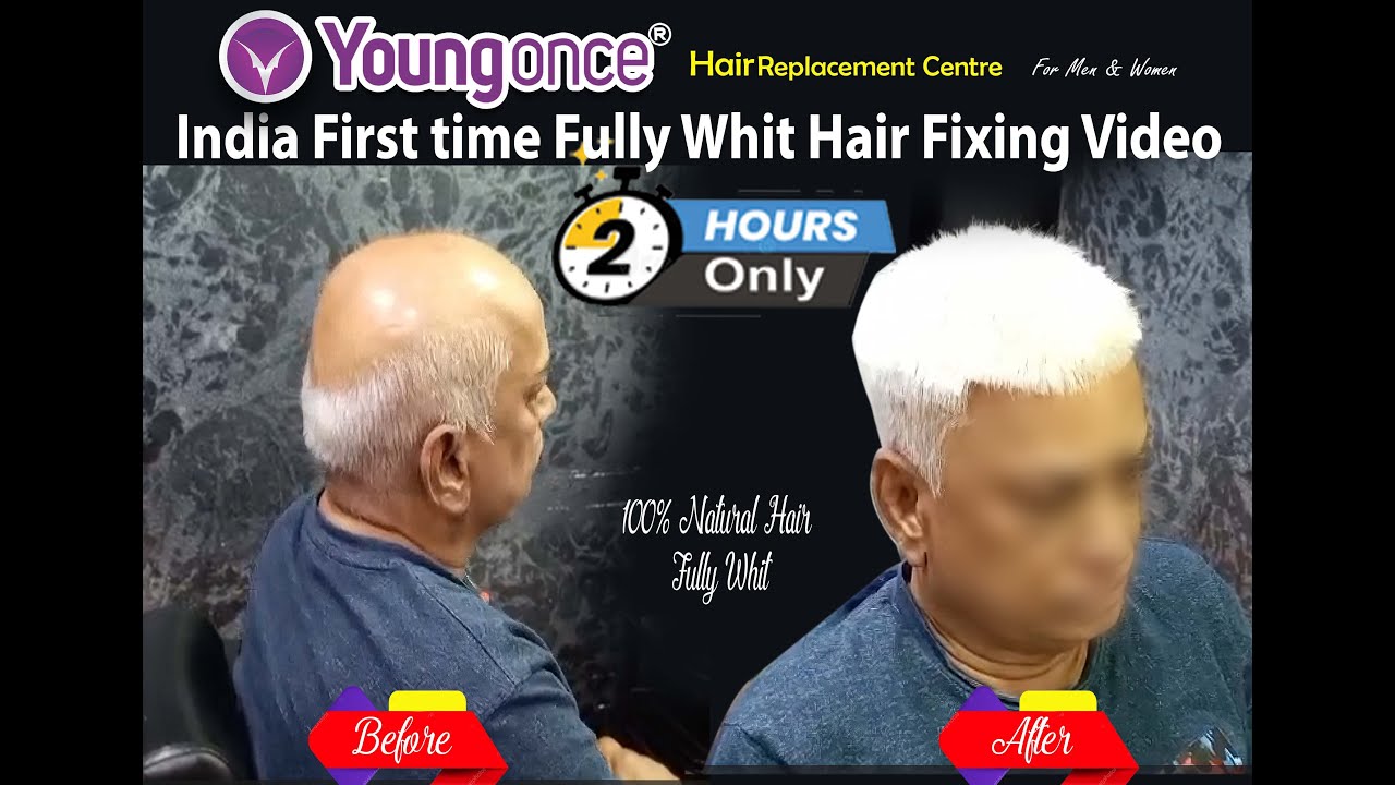#Call : 7503400500 #hairstyle #hairpatchfixing #hairfixing #hair #viralvideo #viralvideos #tamilnadu