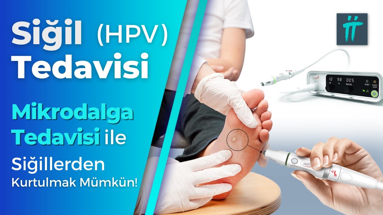 Siğil Tedavisi (HPV Tedavisi): Siğil Kökü Nasıl Çıkarılır? I Turan&Turan