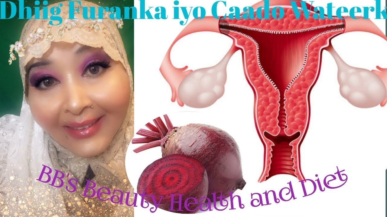 Sidaad Isagadaweynkartit Dhiiga Cadada Oo Furma, Lafaha Xanuunka, Iyo Wareerka Badan