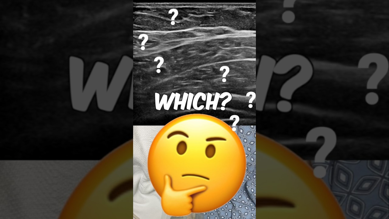 Лучший совет по ТАП! Проблемы с определением слоёв? Попробуйте этот трюк&hellip; #блокаданерва #боль #ул...