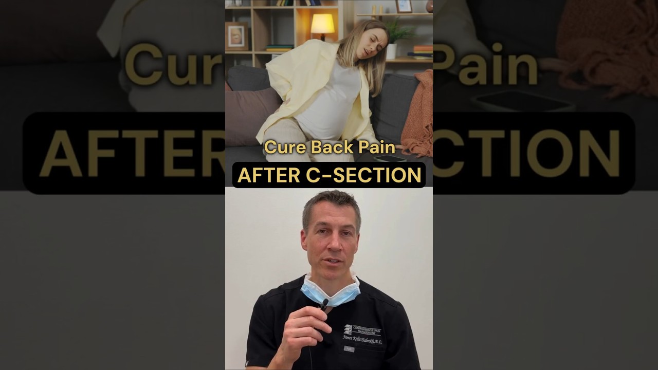 3 Techniques to Relieve Post-C-Section Back Pain | Back Pain after C-section