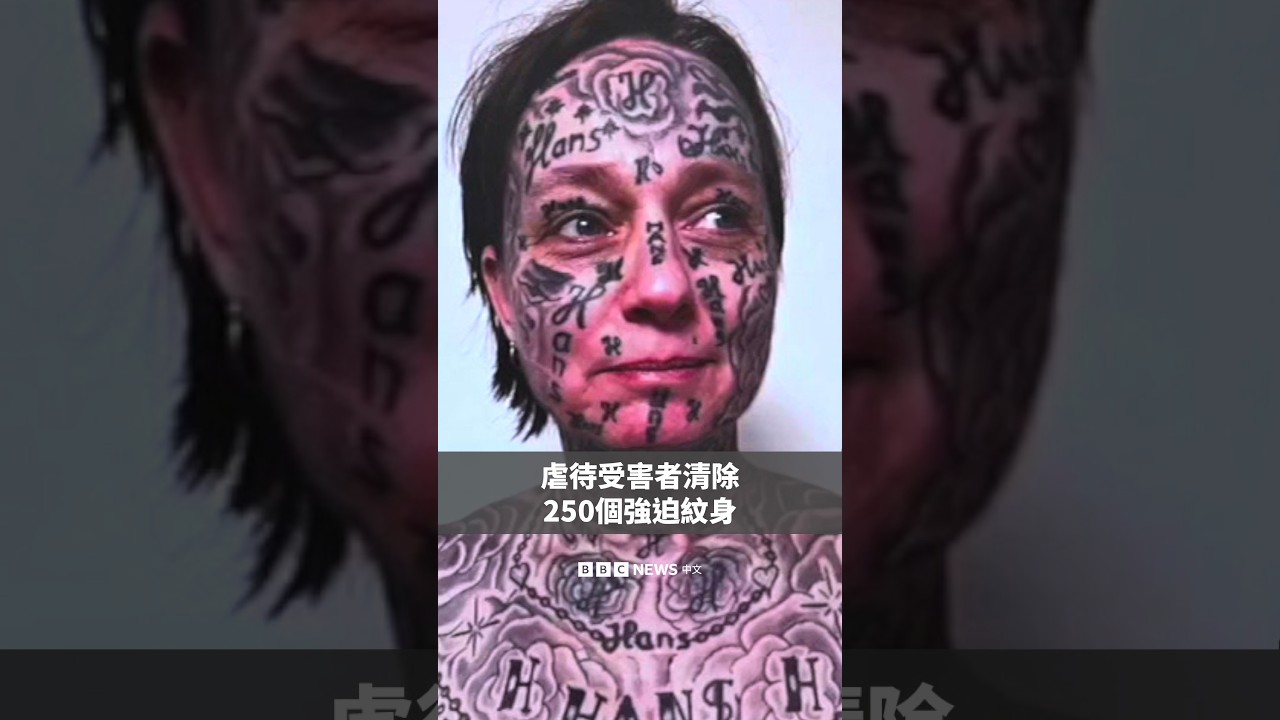 虐待受害者清除250個強迫紋身－ BBC News 中文