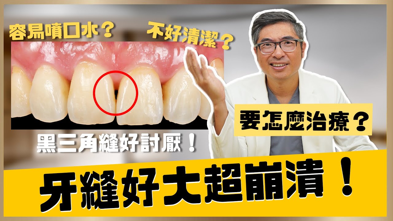 【美學修復 #1】牙齒為什麼會出現黑色三角縫？黑色三角縫是怎麼造成的？黑三角縫完整處理方式大解析｜【祐民牙醫－隱適美旗艦店】鑽石級楊大為醫師