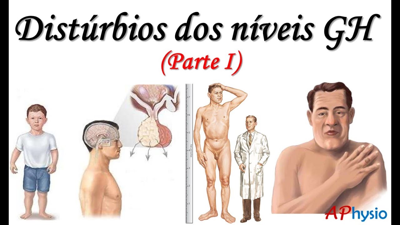 Distúrbios do Hormônio do Crescimento (GH) - Parte I