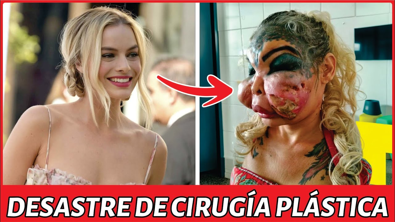 30 Famosos Antes y Despu&eacute;s de la Cirug&iacute;a Pl&aacute;stica | Antes y Despu&eacute;s 2025