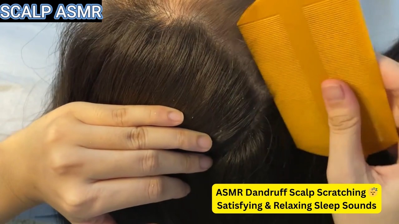 ASMR Dandruff Scalp Scratching 😴 Satisfying & Relaxing Sleep Sounds @ASMRAnnieYT   #32