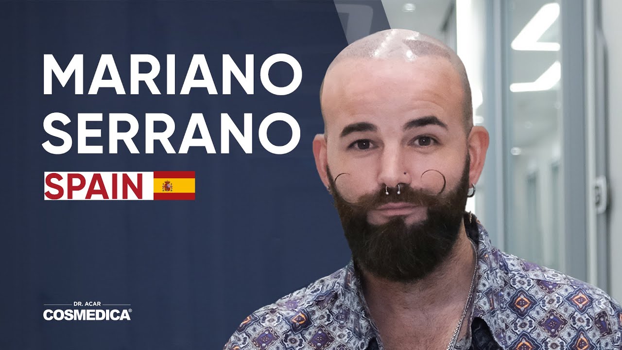 Mariano Serrano Hair Transplant Review | Dr. Acar | Cosmedica Clinic