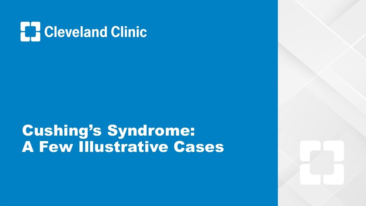 Cushing’s Syndrome: A Few Illustrative Cases