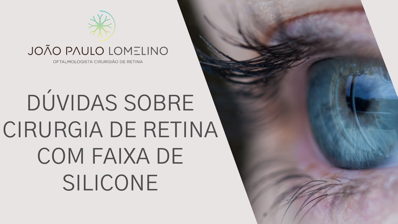 Dúvidas sobre cirurgia de retina com a faixa de silicone | Dr. João Paulo Lomelino