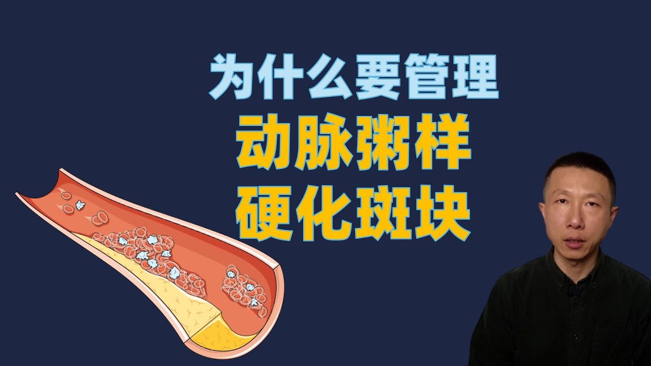 为什么要管理动脉粥样硬化斑块
