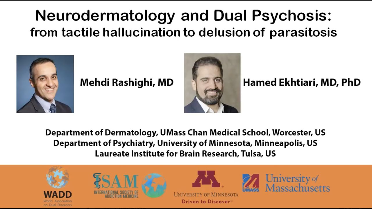 Delusion of Parasitosis: Where Dermatology Meets Neuroscience, Psychiatry and Addiction Medicine