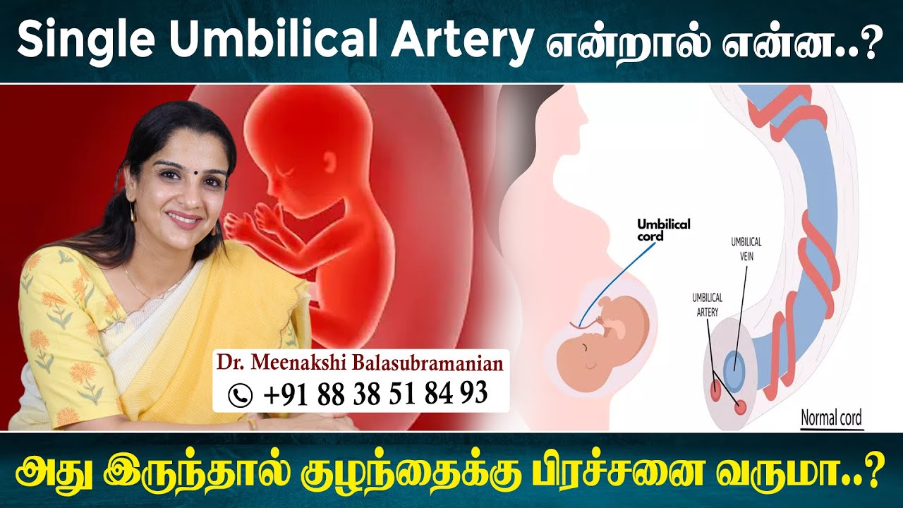 Single umbilical artery in Pregnancy and its significance..! - KRIA Women's Clinic