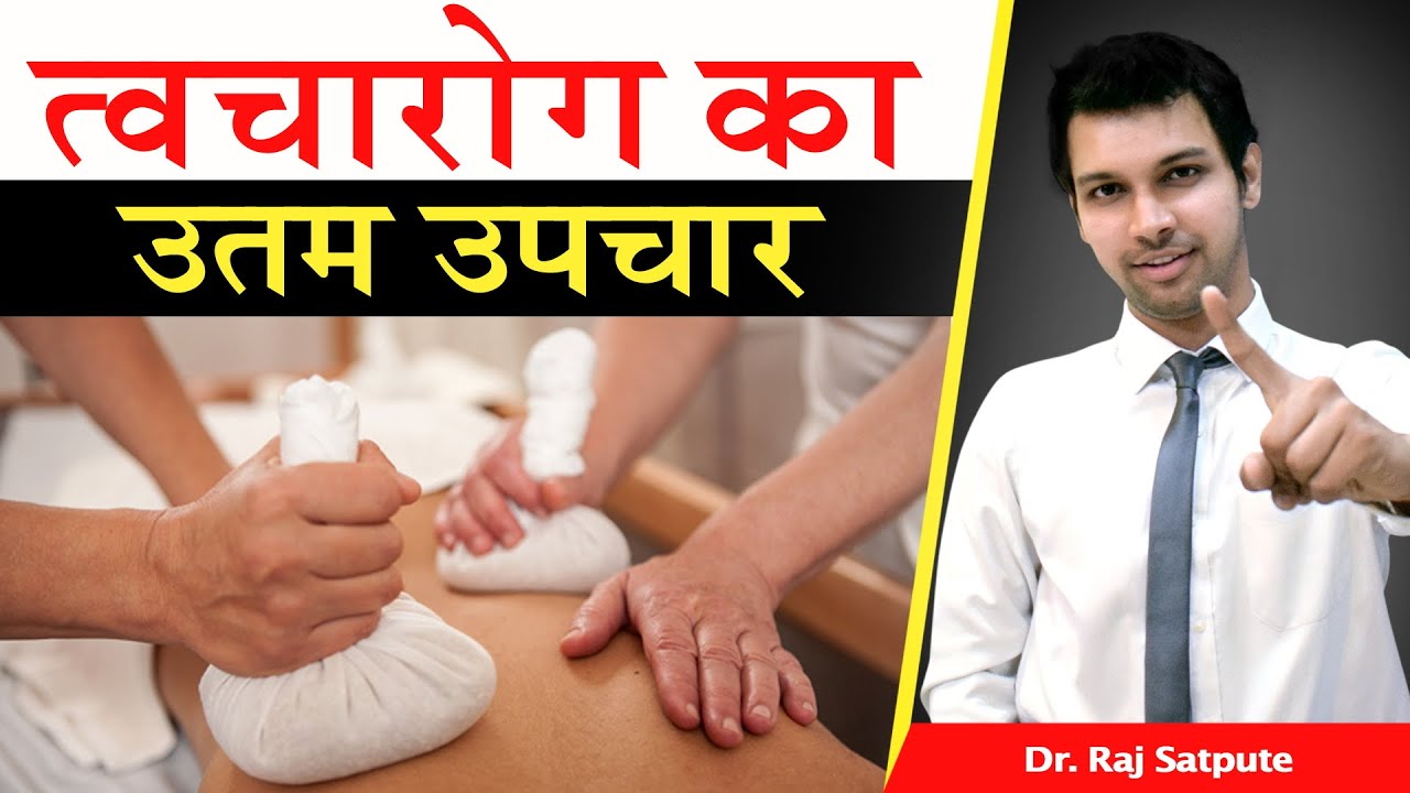 त्वचा विकार की बेस्ट घरेलु उपाय | Cure Psoriasis, Pigmentation, Lichen Planus, Eczema 100% in Hindi