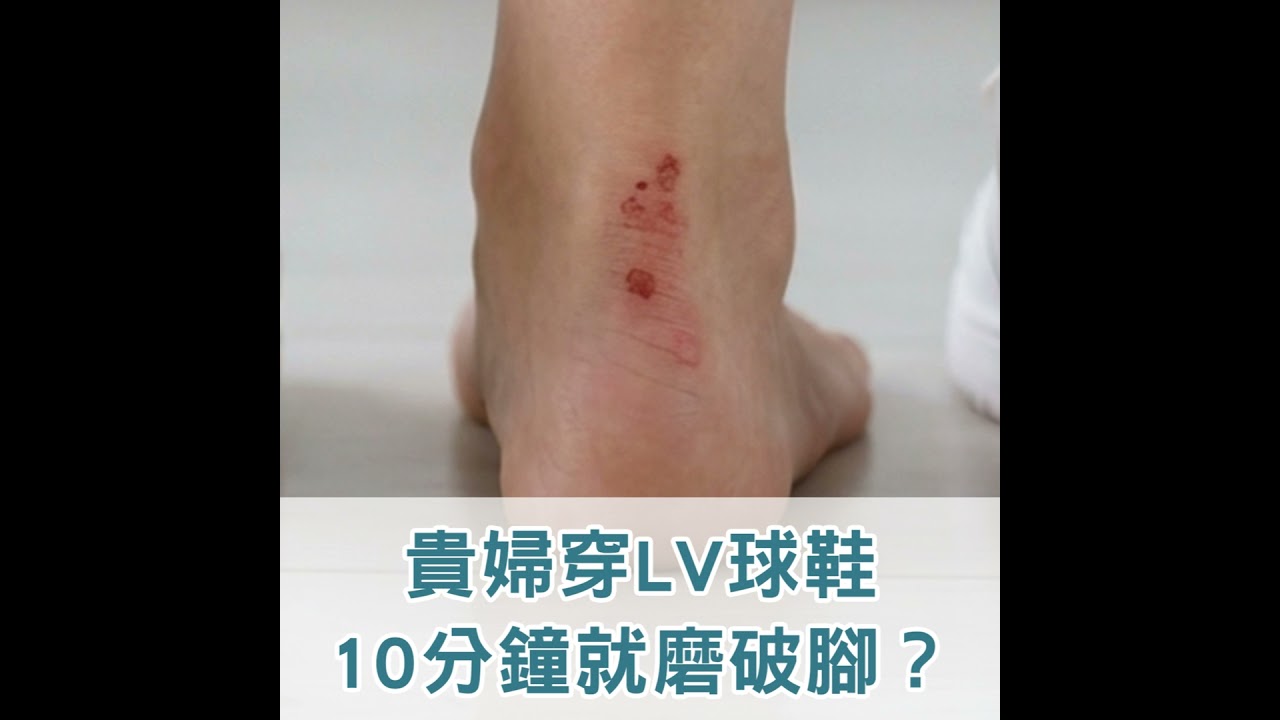【S2 EP.128】貴婦穿LV球鞋10分鐘就磨破腳？