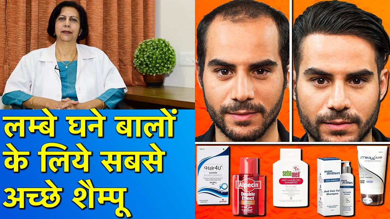 ५ सबसे अच्छे बाल झड़ना रोकने वाले शैम्पू || 5 Best Anti Hair loss and Hair Growth Shampoos
