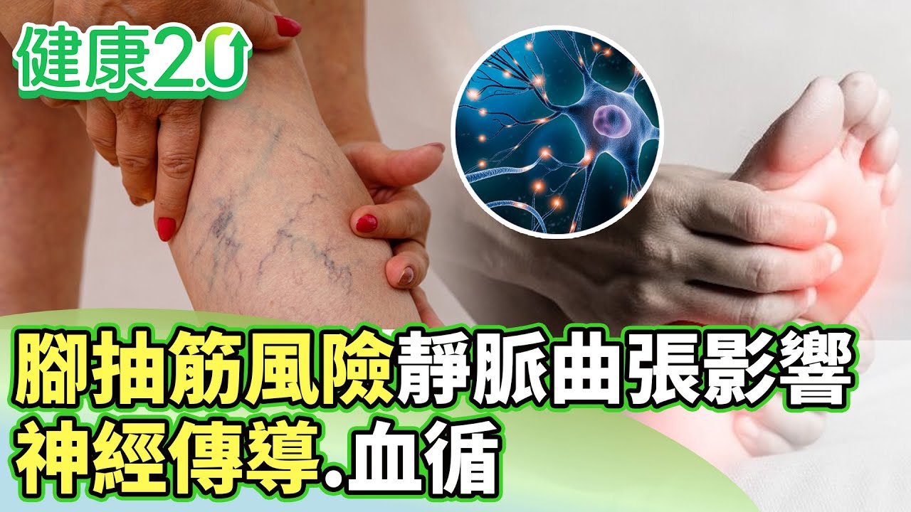 腳抽筋風險增 下肢靜脈曲張影響神經傳導.血循【健康2.0分段】@tvbshealth20  EP3172-3 20260208 #陳欣湄#韋汝#劉子洋#柳朋馳#許瓊月#胡逸惟#雷議宗