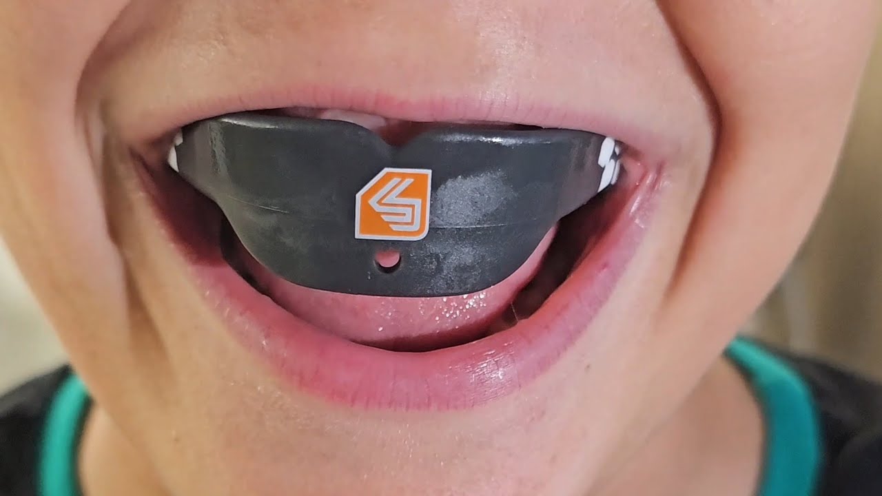 FORMIRANJE ZASTITNE GUME ZA ZUBE #mouthguard