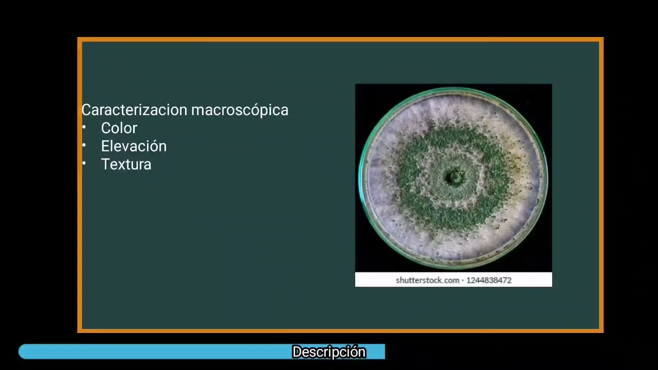 aislamiento de Tricoderma (microbiología agricola)