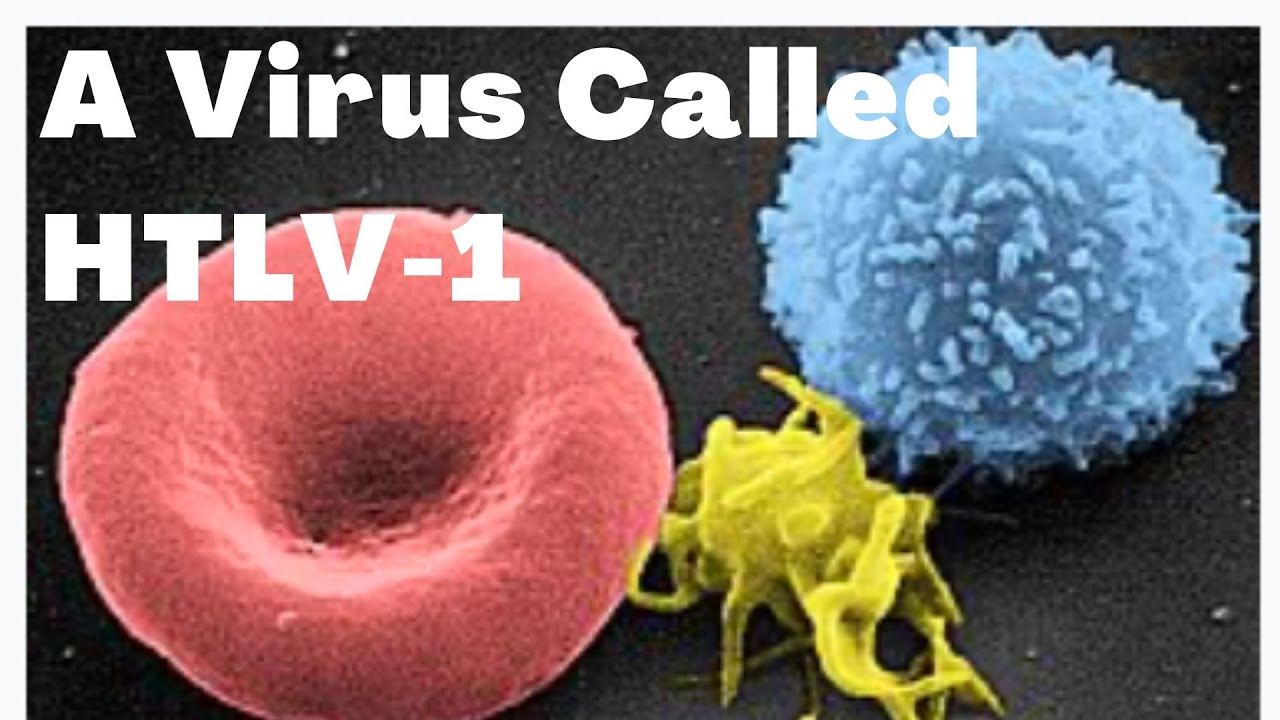 HUMAN T-LYMPHOTROPIC VIRUS | HTLV1 | ADULT T-CELL LEUKEMIA / LYMPHOMA | Adwoa Biotech