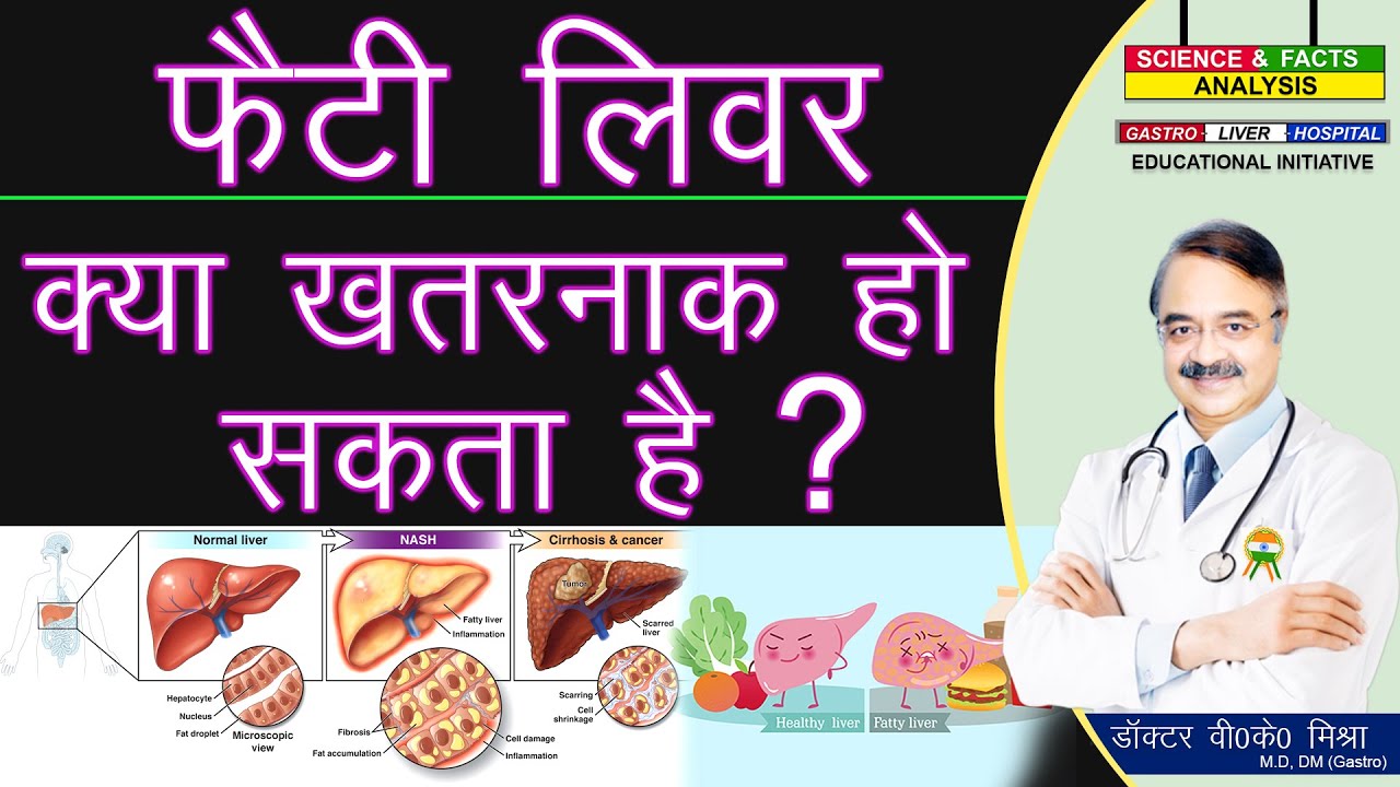 फैटी लिवर क्या खतरनाक हो सकता है ? || FATTY LIVER GENERAL UNDERSTANDING