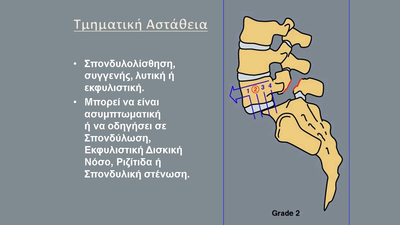 ΡΙΖΙΤΙΔΑ  Πενταράκης Μανούσος Ορθοπαιδικός Χειρουργός