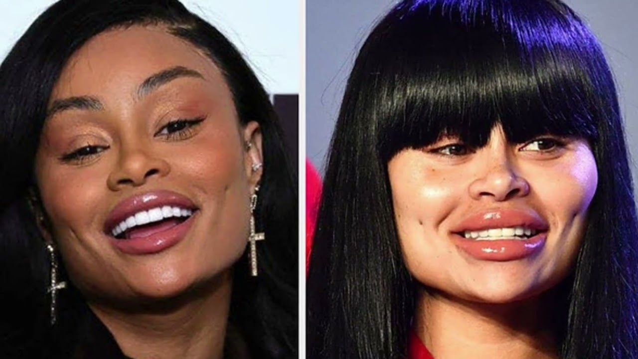 Industry Pressures: Colorism & BBL culture | What is Lightskin Privilege? | BBL Trend out of style?